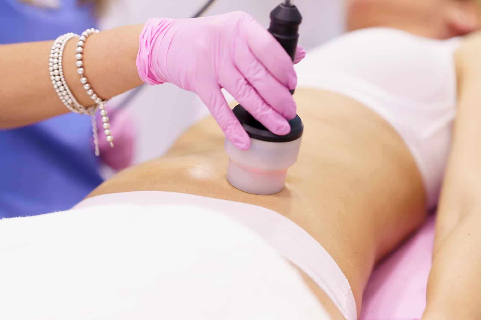 40241724 femme recevant un traitement anti-cellulite avec une machine à radiofréquence dans un centre de beauté