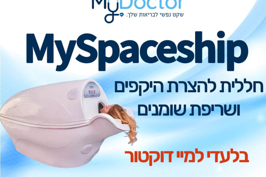 MySpaceship - Réduction de la circonférence