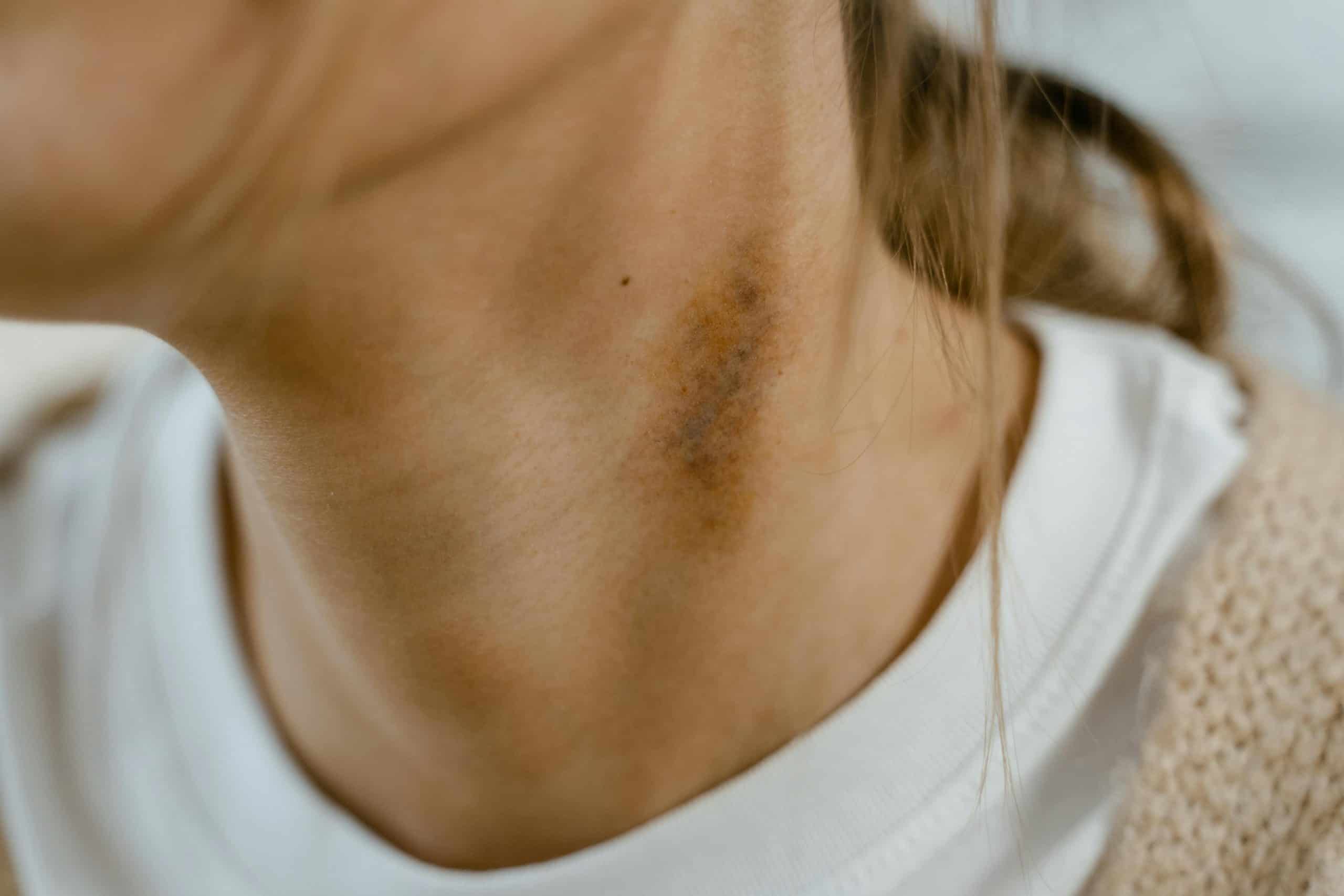 בלוג רפואה 456 pexels photo 7699292 scaled
